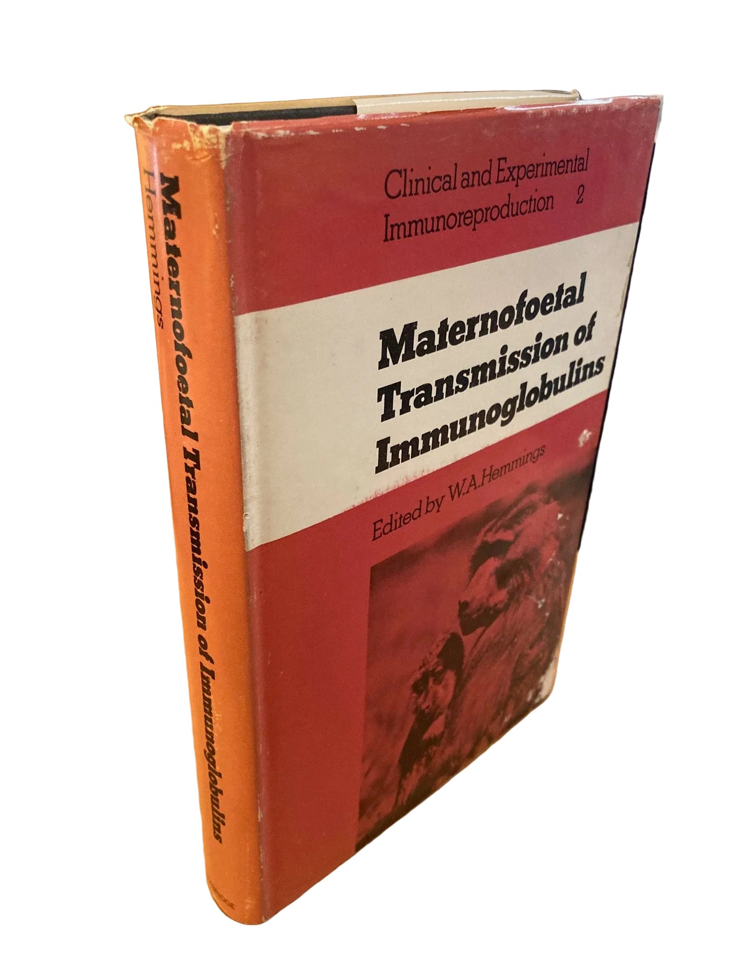 Maternofoetal Transmission of Immunoglobulins